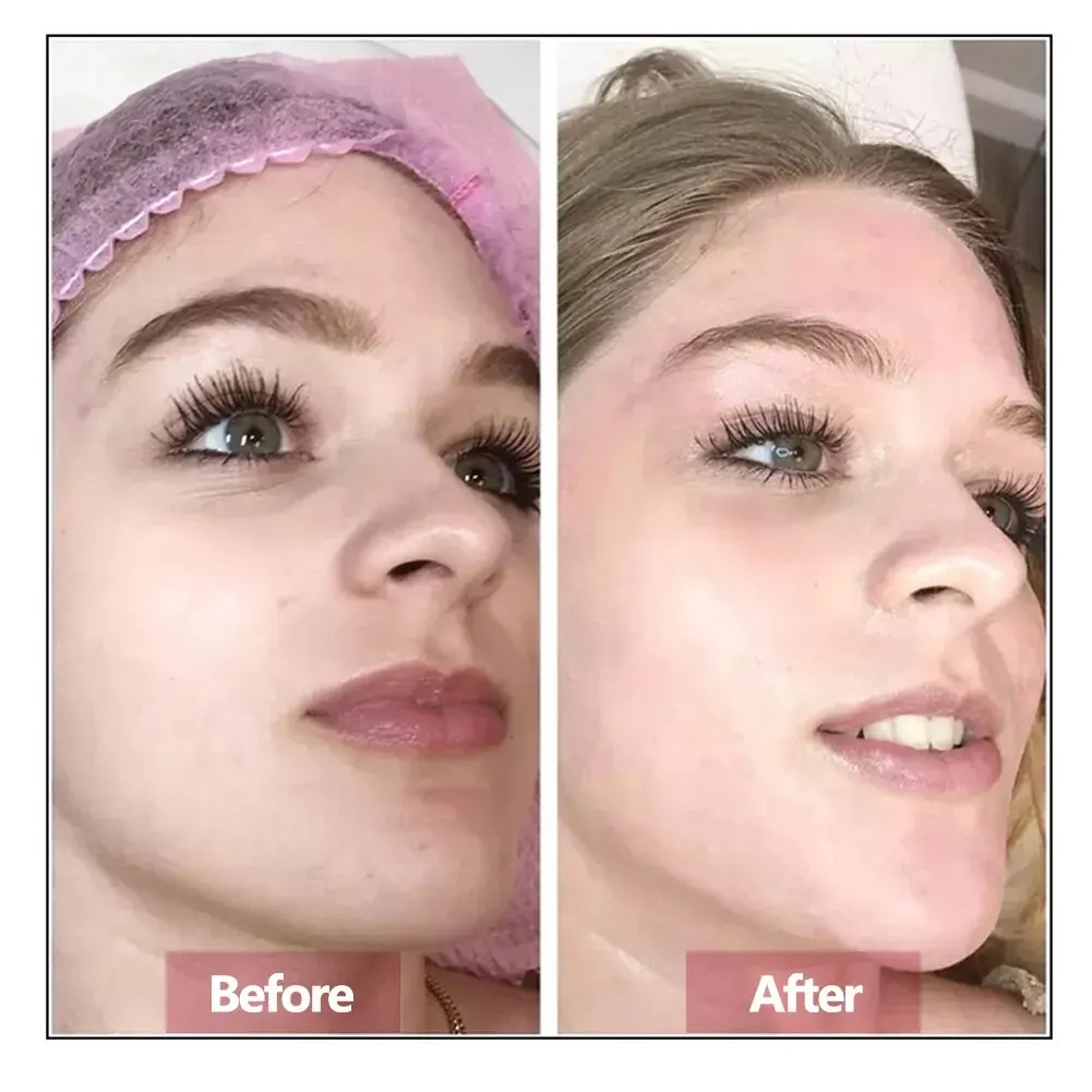 Hyaluronic Acid Face Serum Essence Skin Repair Rejuvenation Firming - Image 3